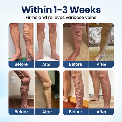 Cheeroll@  Deep Vein Repair Microneedle Patch